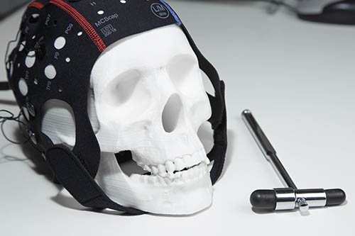 Морфотипы старения лица итог