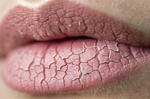 Витамин А, что происходит при дефиците